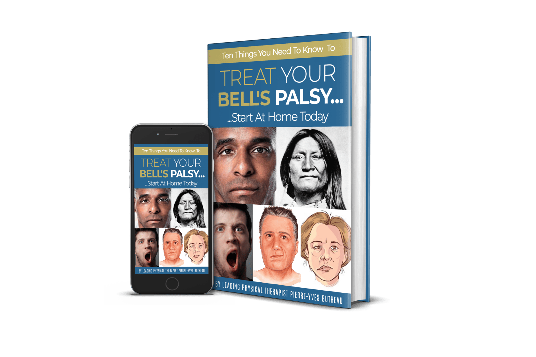 Bell_s Palsy Ebook Cover