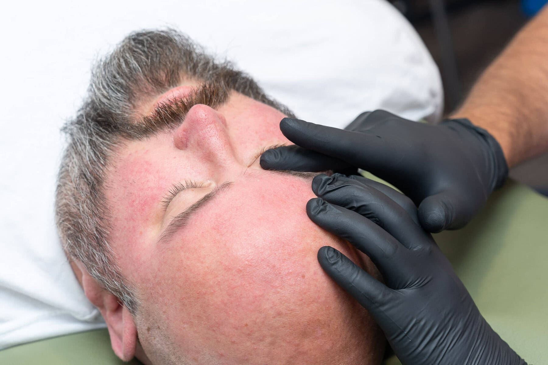 Butheau Facialparalysis2