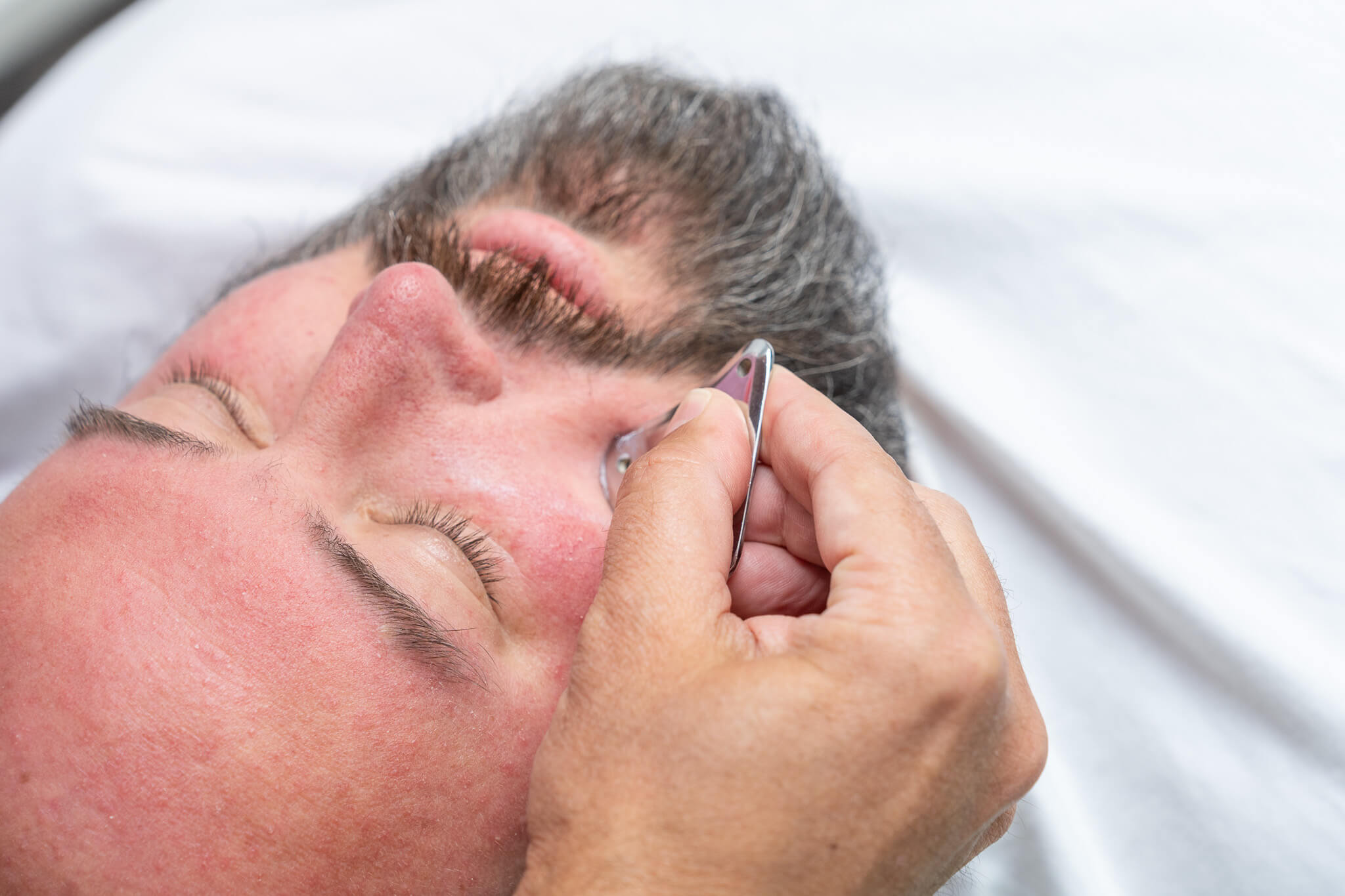 Butheau Facialparalysis4